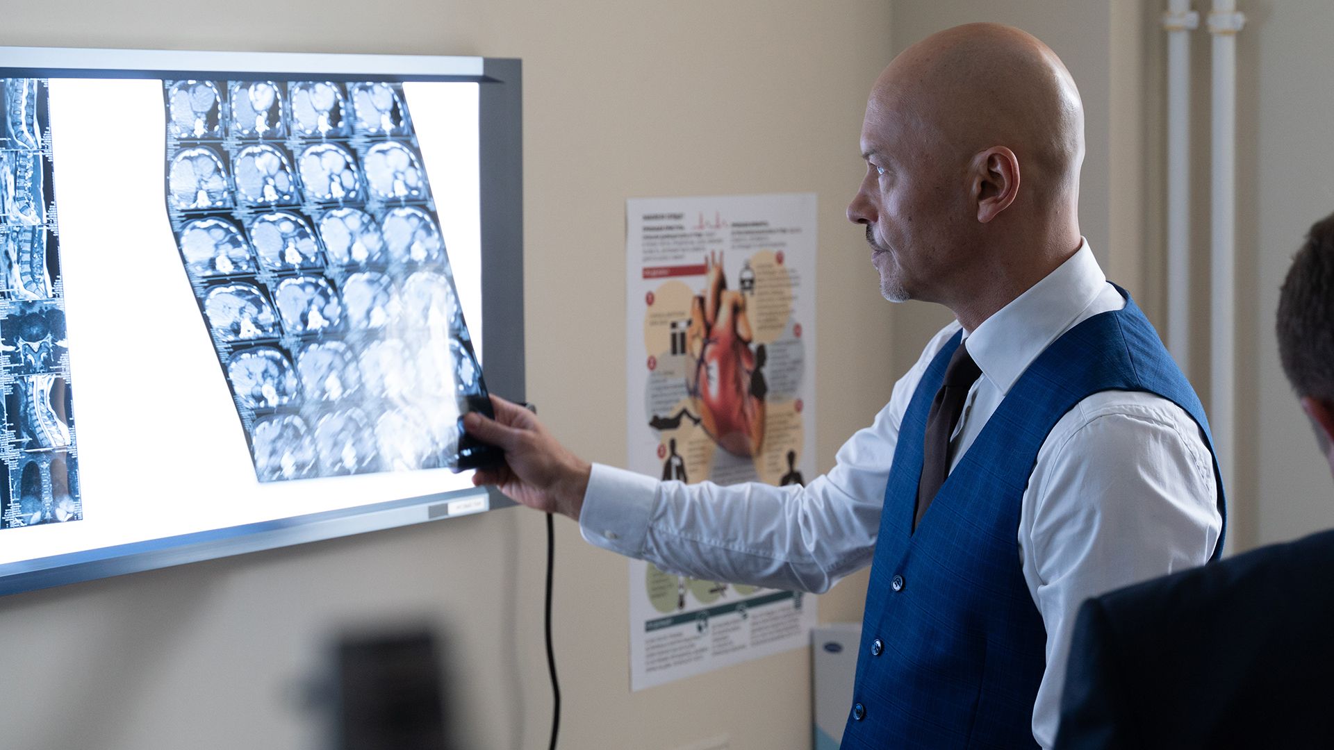 Филатов. 5-я серия